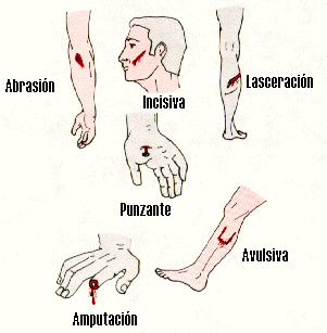 Clasificación de las Heridas